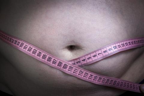 overgewicht; buikvet